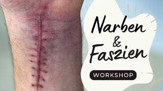 Workshop Narben amp Faszien [upl. by Ater310]