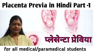 What is Placenta Previa causestypessigns amp symptoms part1  प्लेसेंटा प्रेविया कारणलक्षणप्रकार [upl. by Malonis299]