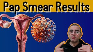 Pap Smear 101  Explained Pap Smear results meaning Pap Test [upl. by Douglass]