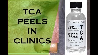 TCA PEELS IN CLINICS for Syringoma Removal [upl. by Danas126]