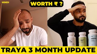 ✅ Traya Hair Regrowth👩‍🦲3 Month Progress Update 👉 My Honest Opinion 🟡 from hair loss to Thicker Hair [upl. by Gothurd]