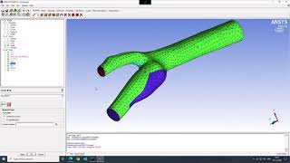 Basic Meshing in IcemCFD  Carotid Tet Mesh with Inflation Layer [upl. by Sidran]