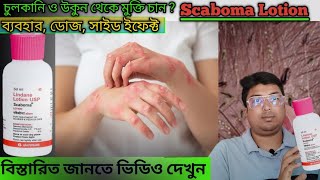 Scaboma Lotion  Scaboma Lotion Uses DoseSide Effect in Bengali  Scabies Treatment  Scaboma [upl. by Ronoh]