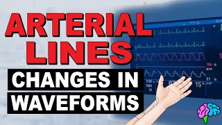 Common Changes in Arterial Line Waveforms [upl. by Vallery493]