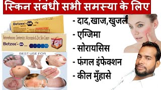 मात्र 5 दिन मे दाद खाज खुजली जड़ खत्म ।। dad khaj khujali ki dava ।। Betzee gm cream uses Hindi [upl. by Noak]