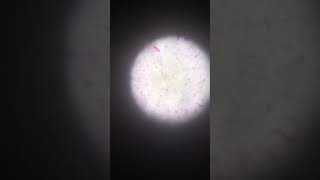 gram negative coccobacilli under microscopic ll blood culture ll microbiology [upl. by Lawan161]