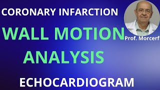 Three rules to analyze LV segmental contraction [upl. by Caton]