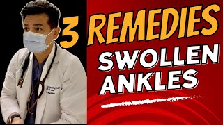 Fast Home Remedies for Swollen Ankles [upl. by Acnalb912]