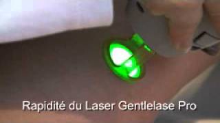 epilation laser au gentlelase proavi [upl. by Sansbury]