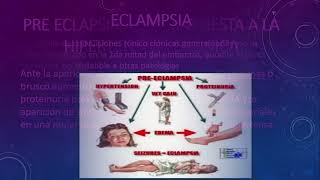 25 Sindromes Hipertensivos y embarazo [upl. by Paryavi679]