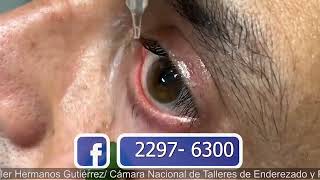 ENDORET PARA EL OJO SECO PTERIGIÓN Y CORNEA SALUD Y ALGO MÁS CANAL 11 Y 4 16 MARZO 2024 [upl. by Rehpotsirhk]