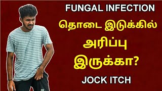 தொடை இடுக்கில் அரிப்பு இருக்கா  Fungal infections  Jock itch  Causes  Prevention  Tamil  MM [upl. by Candy]