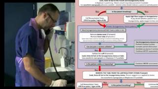 Laryngectomy Detailed Initial Assessment [upl. by Latsyk]