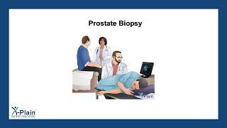 Prostate Biopsy [upl. by Toth]