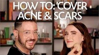 How To Cover Acne amp Scars  Sephora [upl. by Acimehs]