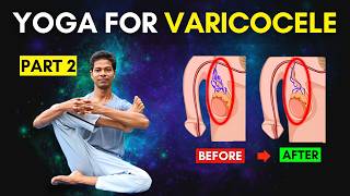 Varicocele Exercises Part 2 At Home  Yoga for Varicocele varicocele [upl. by Ecitnerp]