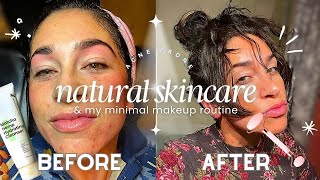 Natural MINIMAL Hormonal Acne Prone SKINCARE Makeup Routinefor acne scarring amp hyperpigmentation [upl. by Emina835]