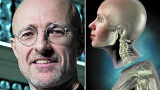 What Happened to the First Human Head Transplant [upl. by Anytsyrk]