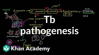 TB pathogenesis  Infectious diseases  NCLEXRN  Khan Academy [upl. by Aleahc]