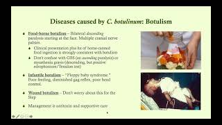 Clostridium botulinum Botulism  Microbiology Boot Camp [upl. by Orsino571]