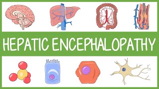 Understanding Hepatic Encephalopathy with Mnemonics [upl. by Dru589]