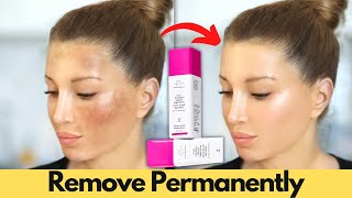 Dark Spot Remover Best Dark Spots Serums for 2024 [upl. by Rolanda501]