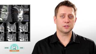 Video Buyers Guide Cone Beam 3d Imaging [upl. by Sanbo]