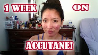 Week 1 on Isotretinoin Accutane  How to Get amp Results [upl. by Higgs472]