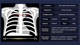 Pulmonary Flow Murmur [upl. by Akirehc]