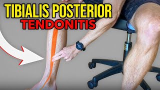 3 Exercises for Tibialis Posterior Tendonitis [upl. by Sucitivel]