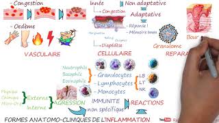 FORMES ANATOMO CLINIQUES DE L’INFLAMMATION  L’essentiel [upl. by Berners494]