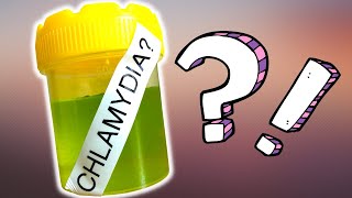 You could have CHLAMYDIA TRACHOMATIS [upl. by Terrence465]