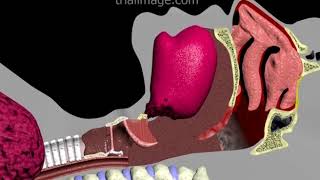 Endotracheal Intubation Animation by Cal Shipley MD [upl. by Volnak]