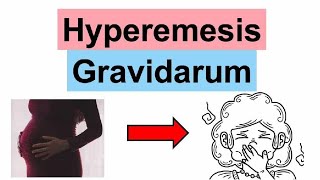 Gynecology Hyperemesis gravidarum HG Dr Doaa Qasim 20242025 [upl. by Wootten]