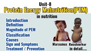 Protein Energy Malnutrition PEM  Kwashiorkor and Marasmus  Protein Energy Malnutrition in hindi [upl. by Nivk435]