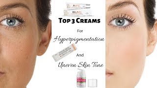 Top 3 Creams For Hyperpigmentation Uneven Skin Tone and Dull Skin  Rabia Skin Care [upl. by Whatley]