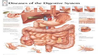 Ultimate Guide to Digestive System Diseases 2024 ibd [upl. by Partridge]