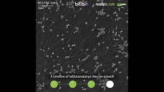 A timeline of ioGlutamateric Neurons [upl. by Sivraj]