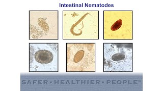 Diagnostic Features of Intestinal Nematodes [upl. by Bratton135]