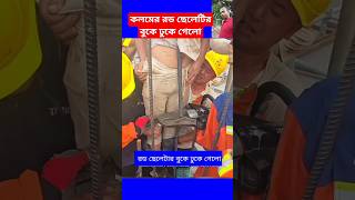 কলমের রড ছেলেটির বুকে ঢুকে গেলোconcrete construction working plan work shorts viral trending [upl. by Tabib450]