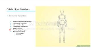 Hipertensión arterial e intracraneal [upl. by Llennyl]