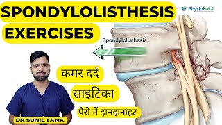 Spondylolisthesis Exercises  Spondylolisthesis physiotherapy treatment  L4L5 L5S1  Sciatica [upl. by Rakso]