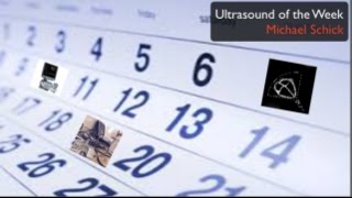 Ultrasound of the Week  Parotitis [upl. by Shari805]