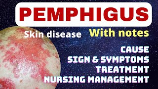 Pemphigus in hindi  cause symptoms treatment nursing management  pemphigus skin problem  msn [upl. by English28]