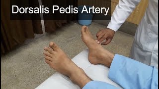 Dorsalis Pedis Artery Clinical Examination [upl. by Sirtimed228]