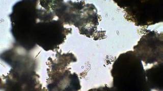 粒子間で見られる微生物たちMicrobes in a narrow space among particles [upl. by Scarface]