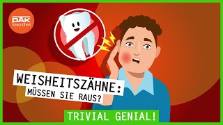 Weisheitszähne Müssen sie raus  trivialgenial  DAKGesundheit [upl. by Seiber]