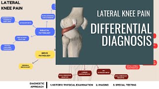 Lateral Knee Pain Differential Diagnosis [upl. by Nyrret707]