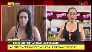 Perdió una pierna tras una liposucción [upl. by Bathelda34]