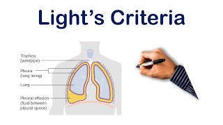 Pleural Effusion Lights Criteria  USMLE STEP COMLEX NCLEX [upl. by Ummersen859]